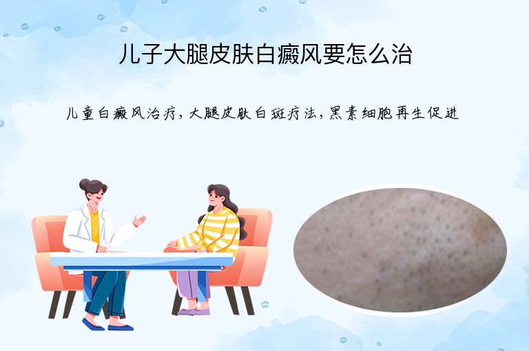 儿子大腿皮肤白癜风要怎么治”