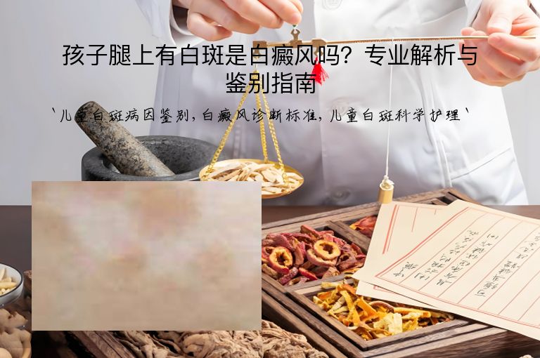 孩子腿上有白斑是白癜风吗？专业解析与鉴别指南”