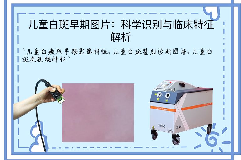 儿童白斑早期图片:科学识别与临床特征解析