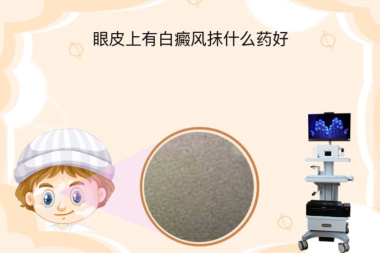 眼皮上有白癜风抹什么药好”