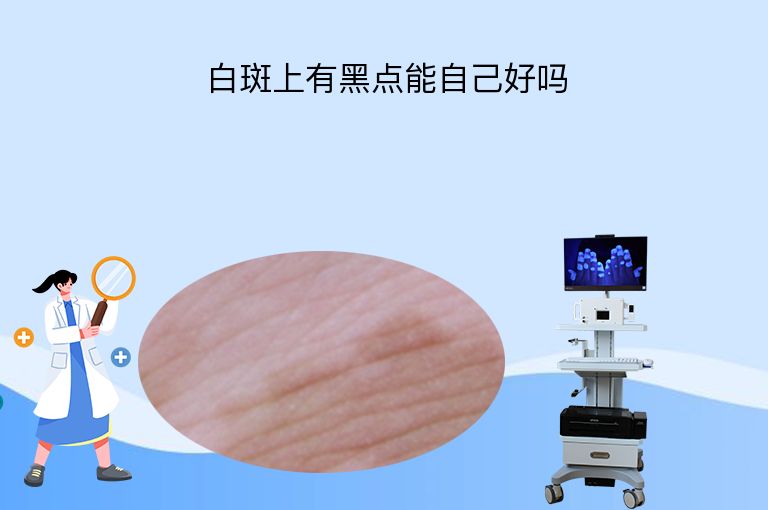 白斑上有黑点能自己好吗”