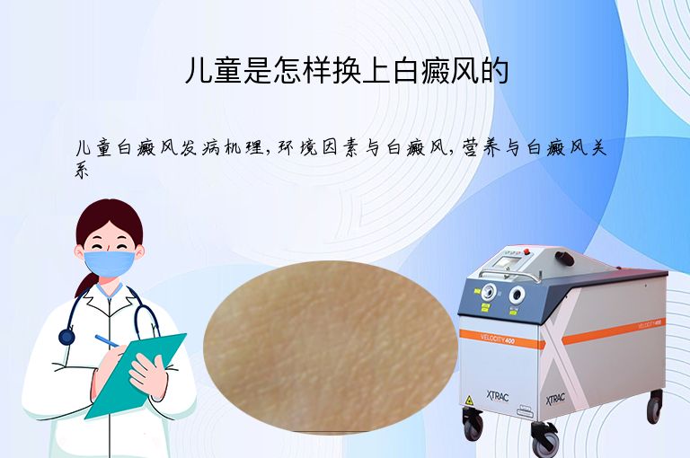 儿童是怎样换上白癜风的”