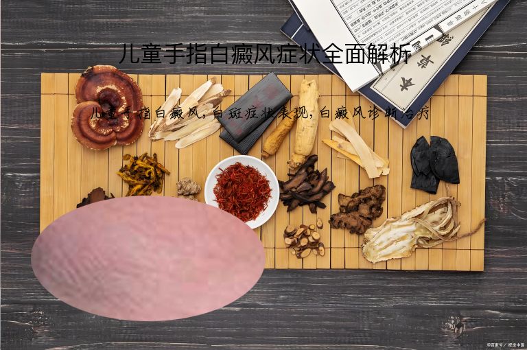 儿童手指白癜风症状全面解析”