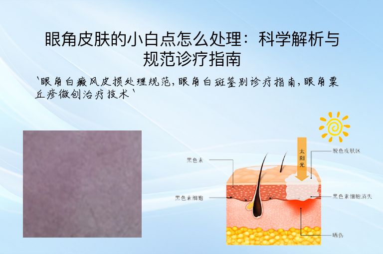 眼角皮肤的小白点怎么处理：科学解析与规范诊疗指南
