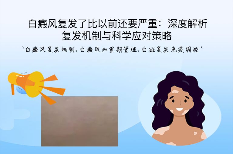 白癜风复发了比以前还要严重:深度解析复发机制与科学应对策略”
