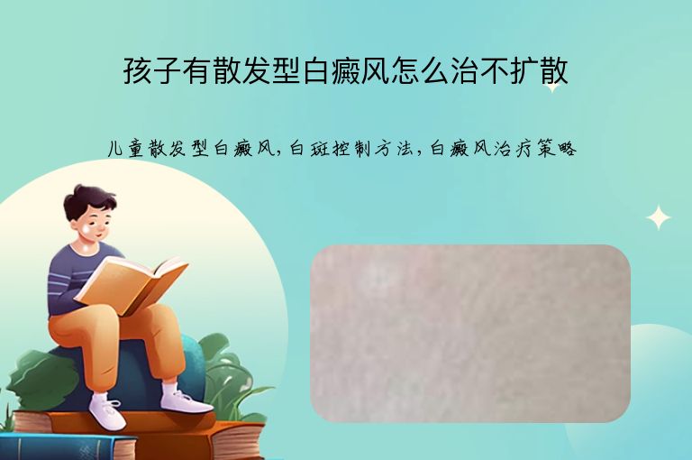 孩子有散发型白癜风怎么治不扩散”