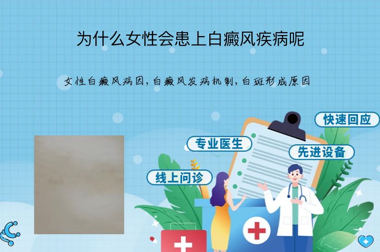 https://www.bdfsjzyy.com/d/file/p/a9ac57cfb3d63b690f3e3b9c28ed96a4.jpeg