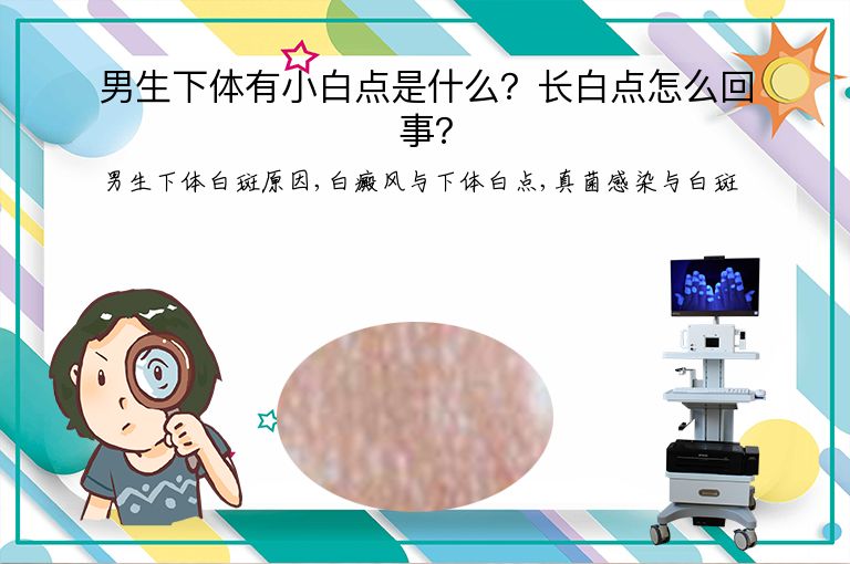 男生下体有小白点是什么?长白点怎么回事?”