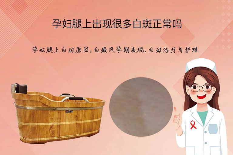 孕妇腿上出现很多白斑正常吗”