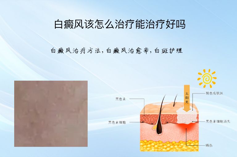 https://www.bdfsjzyy.com/d/file/p/959de34eb3dc8a5fc25bed74e83755b0.jpeg