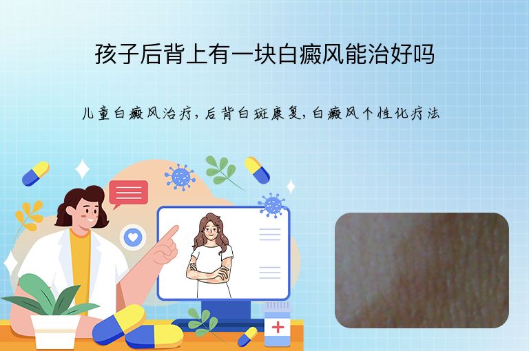 孩子后背上有一块白癜风能治好吗”