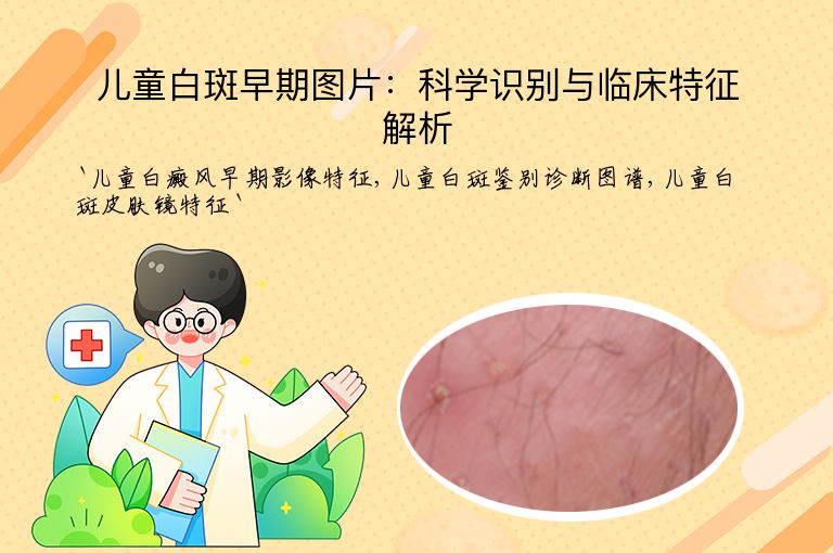 儿童白斑早期图片:科学识别与临床特征解析