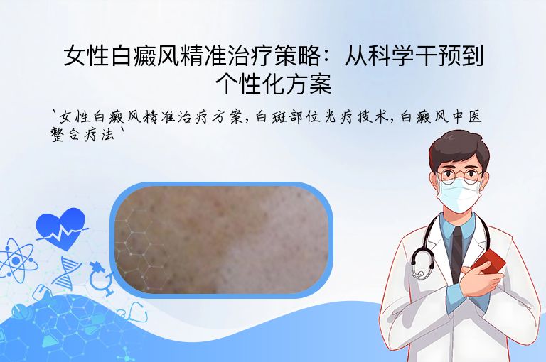 女性白癜风精准治疗策略：从科学干预到个性化方案”