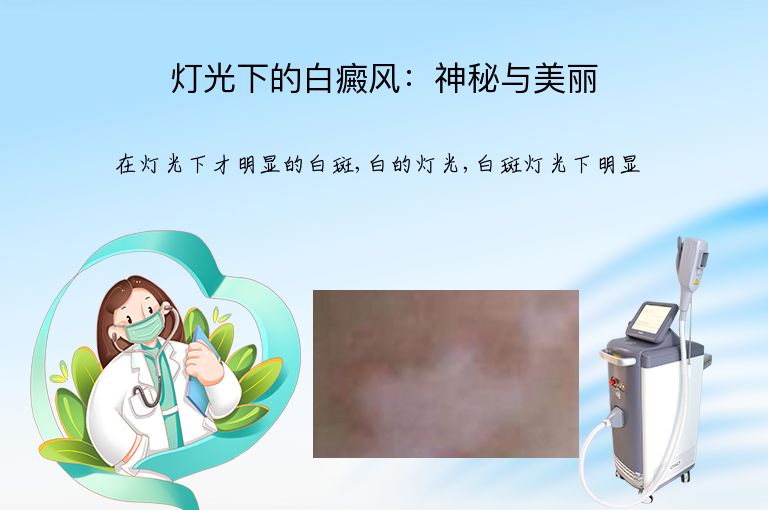 灯光下的白癜风:神秘与美丽”