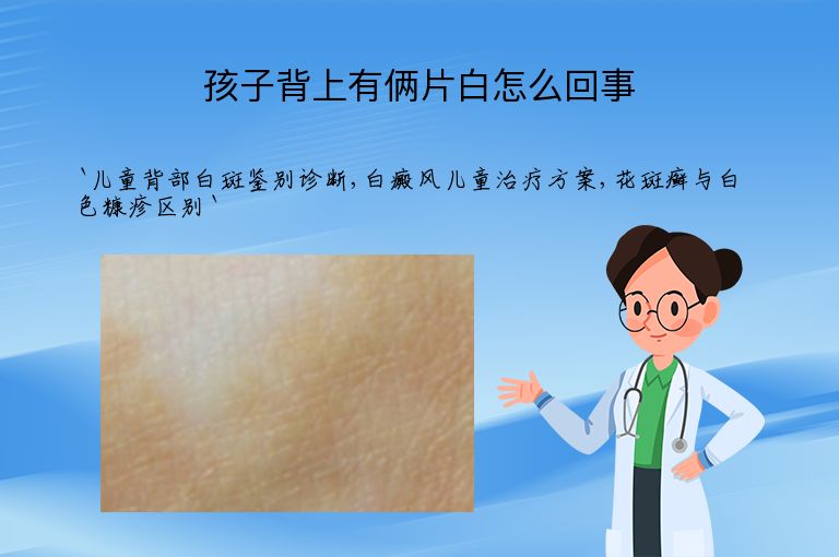 孩子背上有俩片白怎么回事