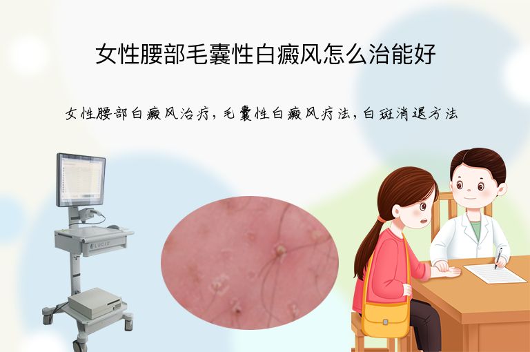 女性腰部毛囊性白癜风怎么治能好”