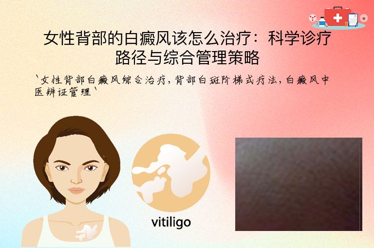 女性背部的白癜风该怎么治疗：科学诊疗路径与综合管理策略