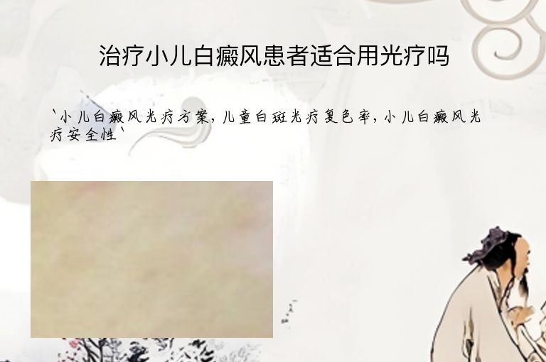 治疗小儿白癜风患者适合用光疗吗