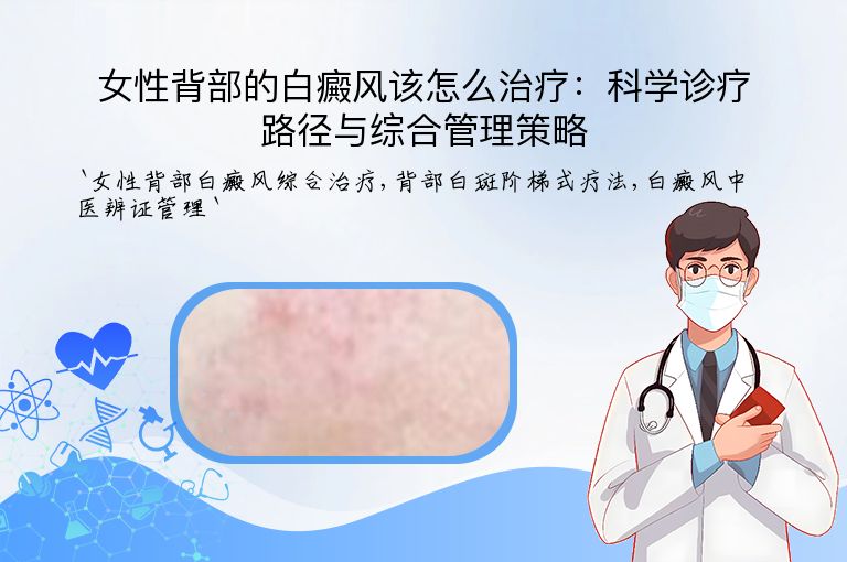 女性背部的白癜风该怎么治疗：科学诊疗路径与综合管理策略