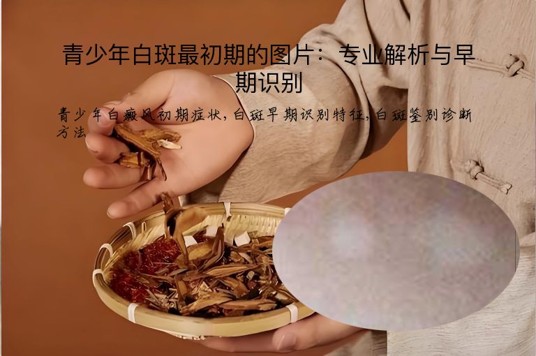 青少年白斑最初期的图片：专业解析与早期识别”