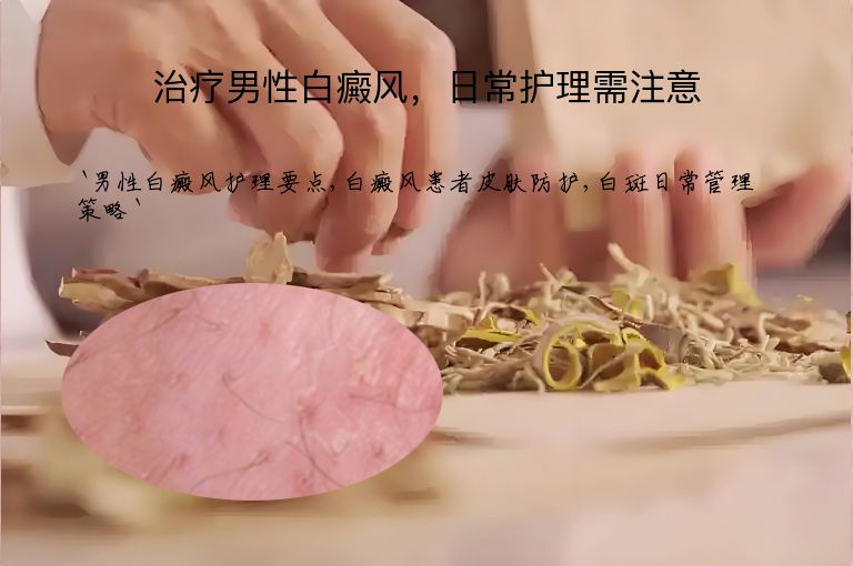 治疗男性白癜风，日常护理需注意”