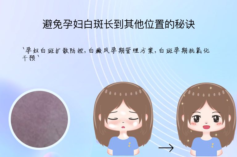 避免孕妇白斑长到其他位置的秘诀