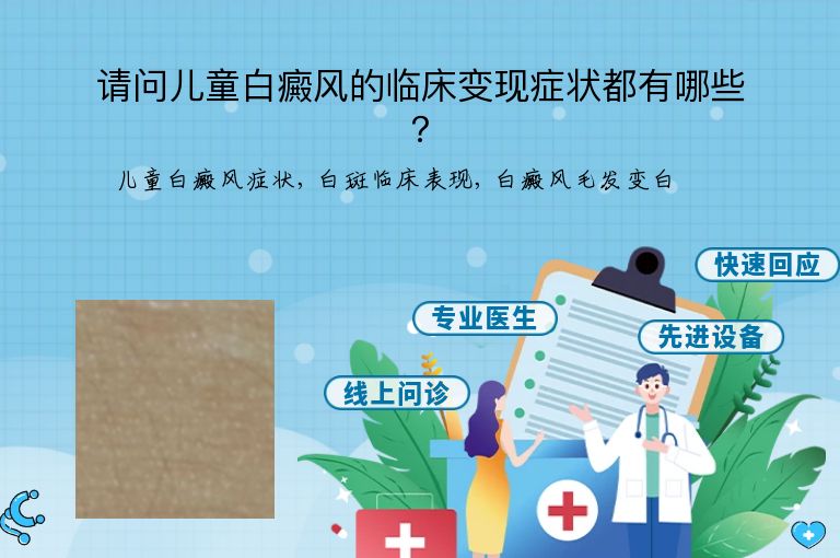 请问儿童白癜风的临床变现症状都有哪些？”