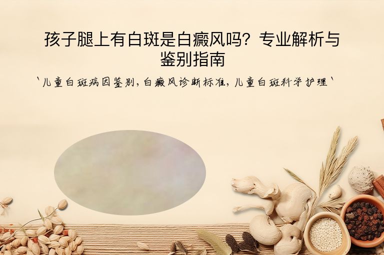 孩子腿上有白斑是白癜风吗？专业解析与鉴别指南”