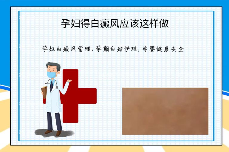 孕妇得白癜风应该这样做”