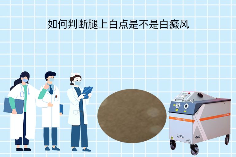 如何判断腿上白点是不是白癜风