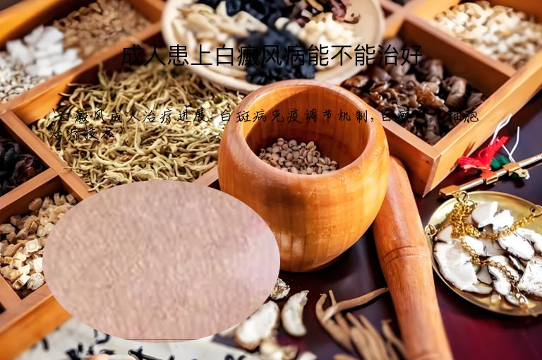 成人患上白癜风病能不能治好”