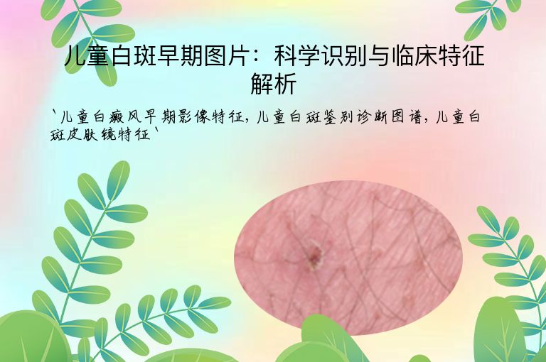 儿童白斑早期图片:科学识别与临床特征解析