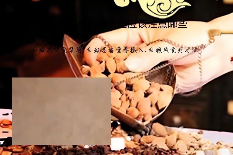 白癜风的饮食方面应该注意哪些”