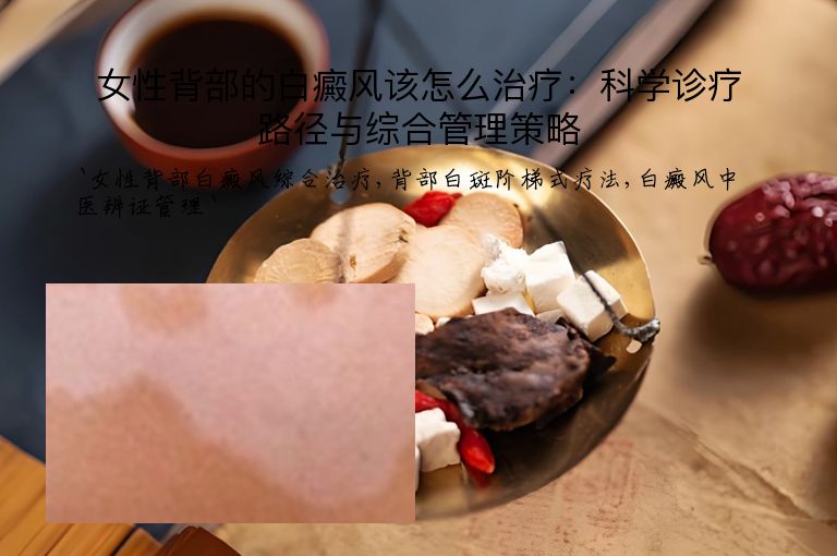 女性背部的白癜风该怎么治疗：科学诊疗路径与综合管理策略