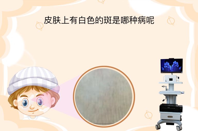https://www.bdfsjzyy.com/d/file/p/34e1c8c018dc758a51447f1dce68a3c6.jpeg