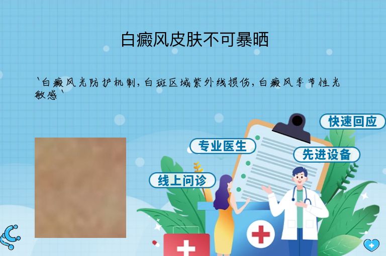白癜风皮肤不可暴晒