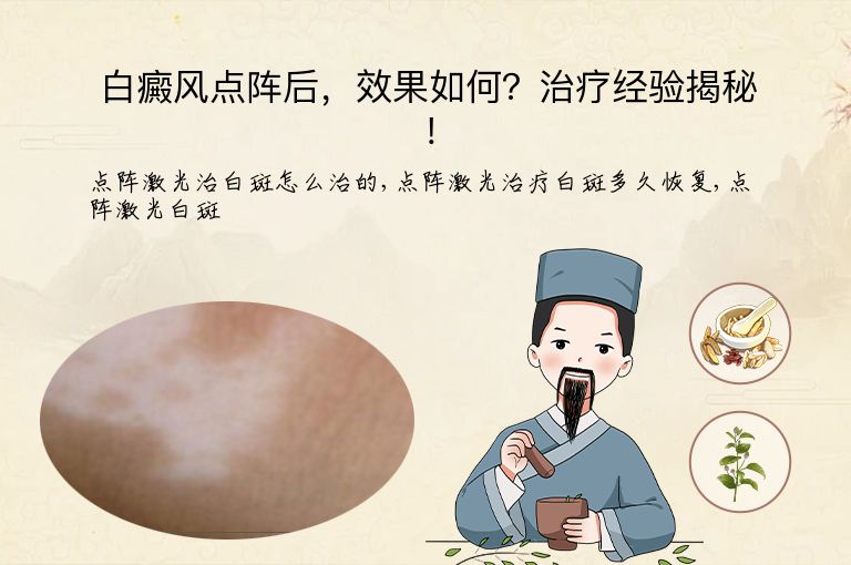 https://www.bdfsjzyy.com/d/file/p/8a6ba085263b3d64574be92715f445ed.jpeg