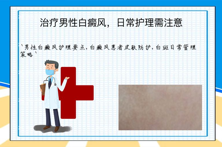 治疗男性白癜风，日常护理需注意