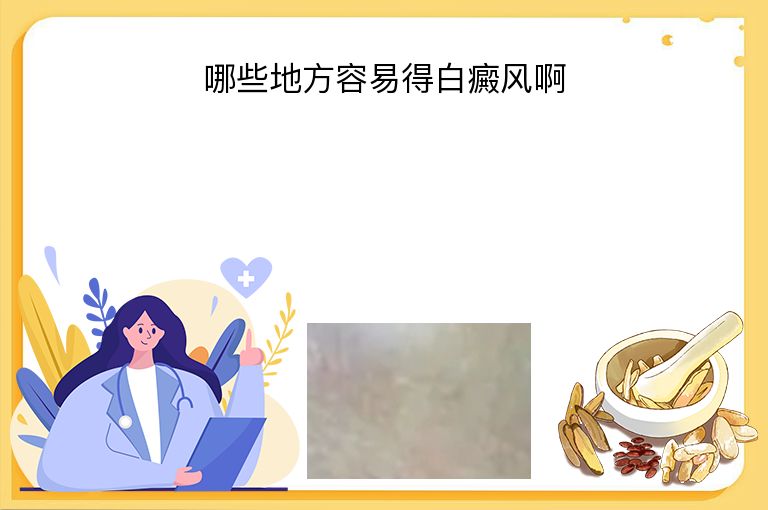 哪些地方容易得白癜风啊”