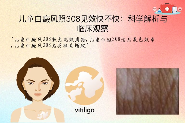 儿童白癜风照308见效快不快：科学解析与临床观察