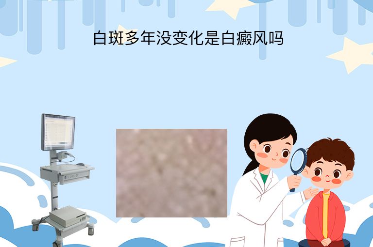 白斑多年没变化是白癜风吗