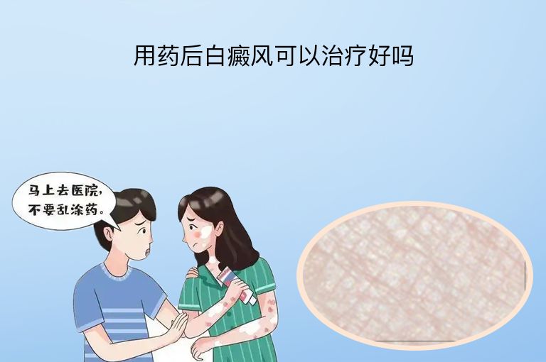 https://www.bdfsjzyy.com/d/file/p/f654c1c33e14f91f33dcd561d8267465.jpeg