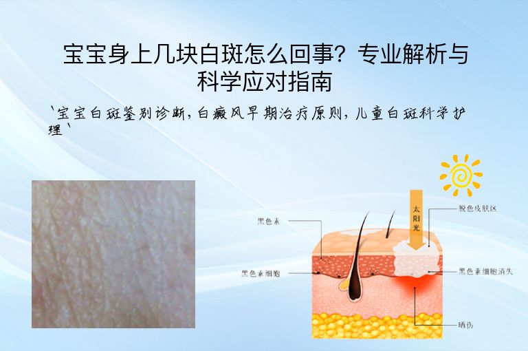 宝宝身上几块白斑怎么回事？专业解析与科学应对指南”