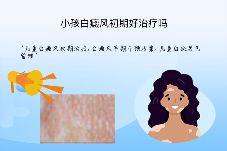 小孩白癜风初期好治疗吗