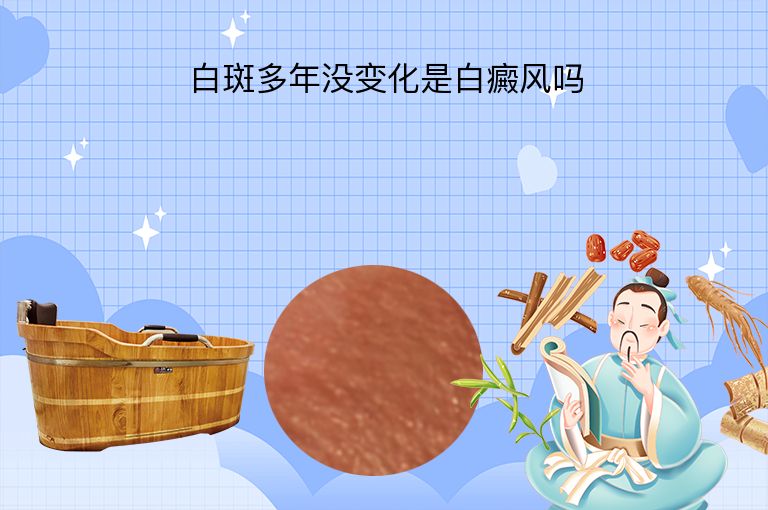 https://www.bdfsjzyy.com/d/file/p/f125bd6016bf9c0ad5c149688b5b73f6.jpeg