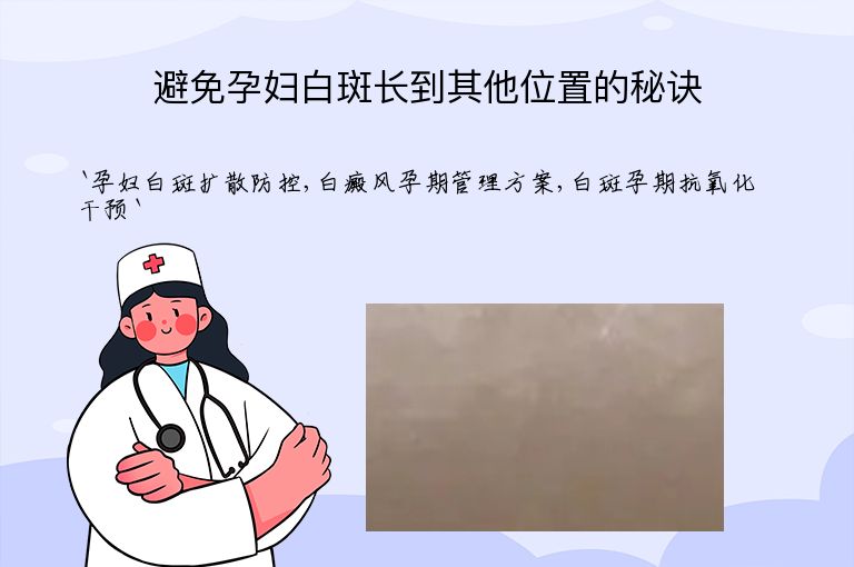 避免孕妇白斑长到其他位置的秘诀