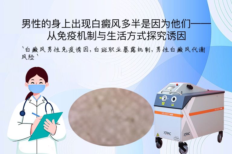 男性的身上出现白癜风多半是因为他们——从免疫机制与生活方式探究诱因