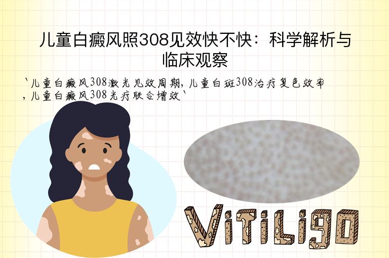 儿童白癜风照308见效快不快：科学解析与临床观察