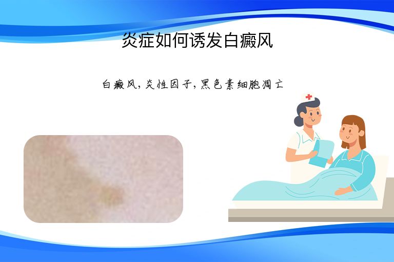 炎症如何诱发白癜风”