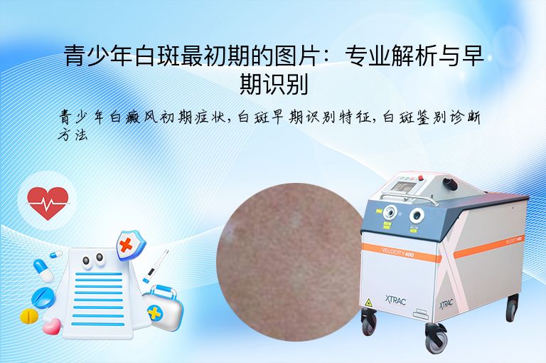 青少年白斑最初期的图片:专业解析与早期识别”